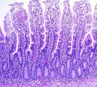 Corte histológico de yeyuno normal Corte histológico de yeyuno normal